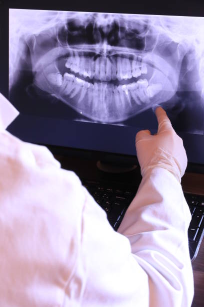Best Emergency Dental Care for Abscessed Tooth in Olean, NY