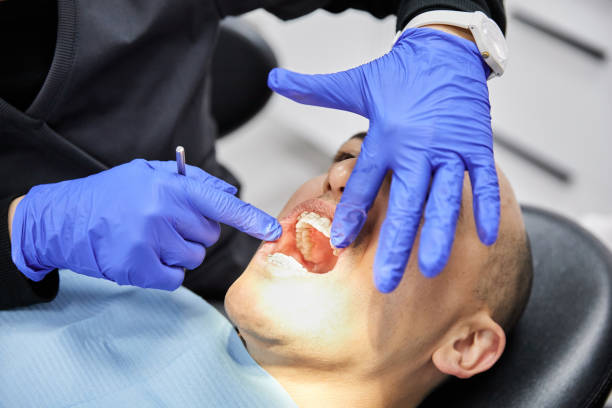 Best Emergency Dental Extractions in Olean, NY