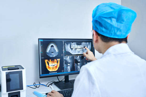 Best Emergency Root Canal Treatment in Olean, NY