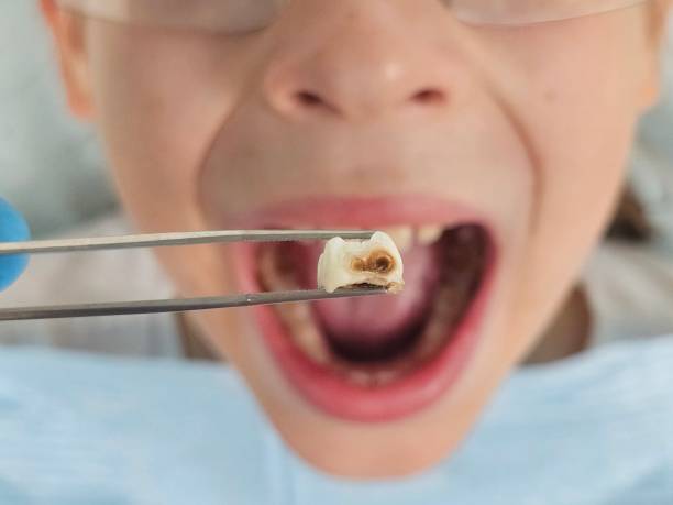 Best Mobile Emergency Dentist in Olean, NY